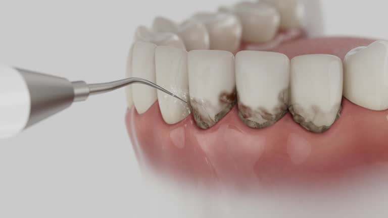Trusted Teeth Cleaning And Checkup service in Bellevue, IA - Dentist Open Now